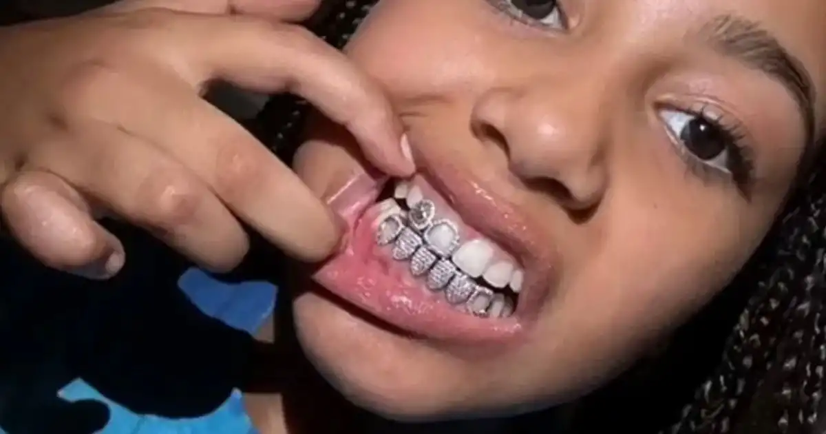 Kanye West hija North diamond grill rapero trabajo dental