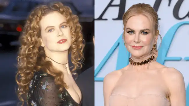 Nicole Kidman habla sobre los rumores de cirugía plástica: 